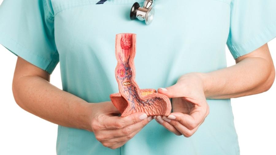 iStock